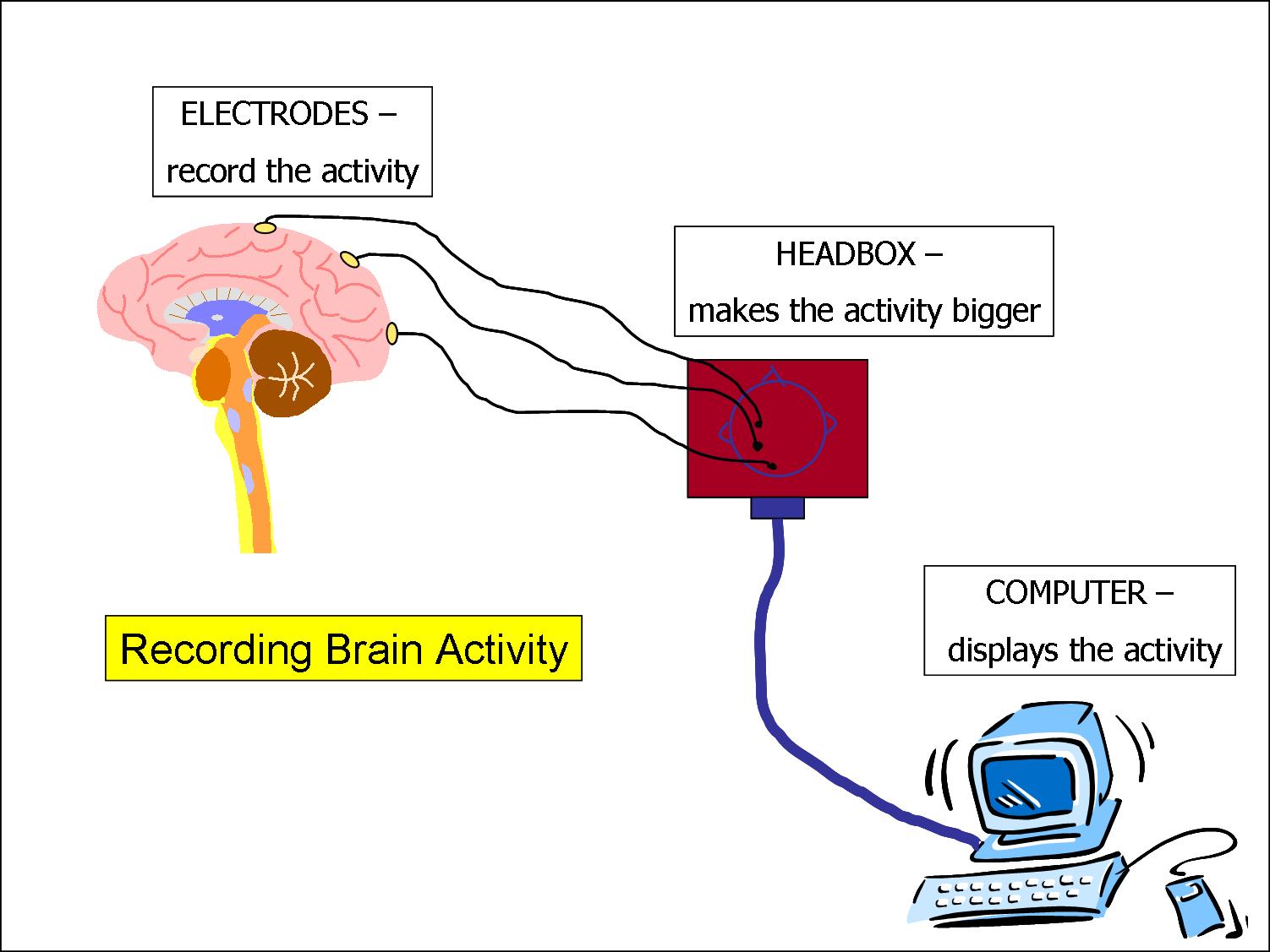 Electroencephalogram (EEG)