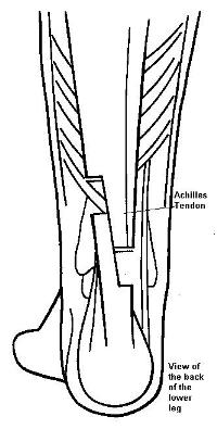 Diagram of leg bones from the back, showing the Achilles tendon