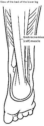 Diagram showing the back of the lower leg with the gastrocnemius (calf) muscle (foot pointing downwards)