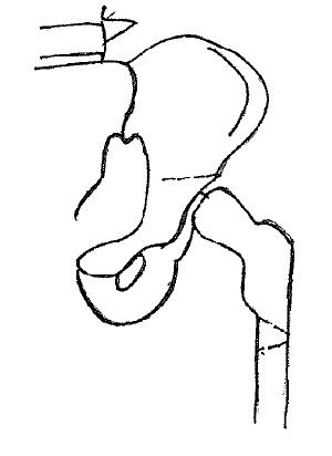 Diagram of pelvic bones. Click for larger version.