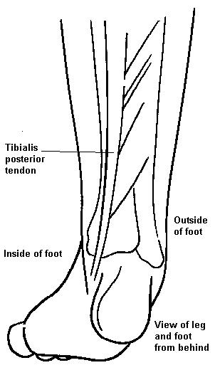 Diagram of leg and foot bones from behind. Click for larger version.