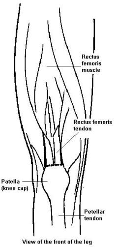 Diagram of leg bones from the front, showing rectus femoris muscle, rectus femoris tendon, patella and patellar tendon