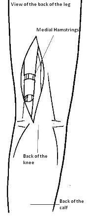 Diagram of the back of the leg showing the medial hamstrings