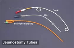 Photo of three different types of jejunostomy tube: Foley (no baloon), Cook, and MIC