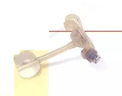 Photo of a Nutriport tube (balloon-type device)