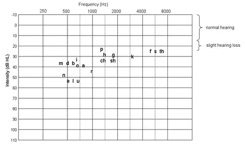 Slight hearing loss with sounds
