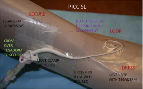 PICC Dressing